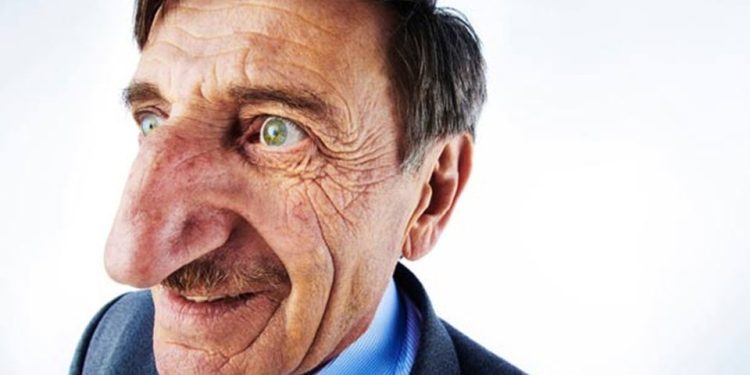 ‘Eu amo, fui abençoado’, diz turco com o maior nariz do mundo segundo livro dos recordes