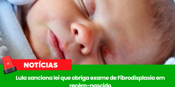 Lula sanciona lei que obriga exame de Fibrodisplasia em recém-nascido